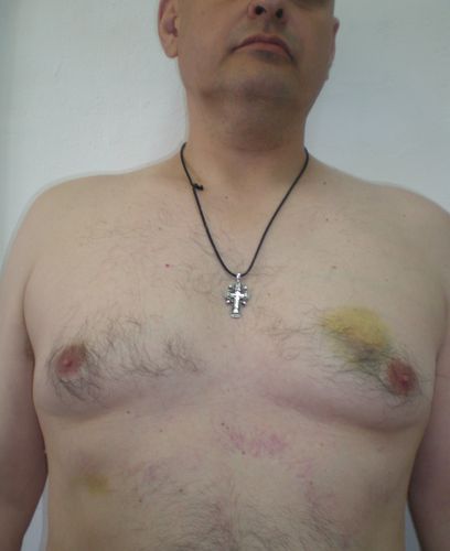 К.Душенов, следы побоев