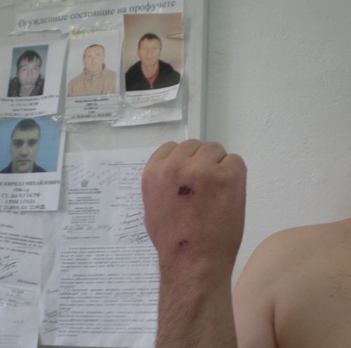 К.Душенов, следы побоев
